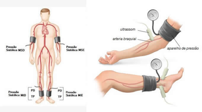 Índice Tornozelo-Braquial